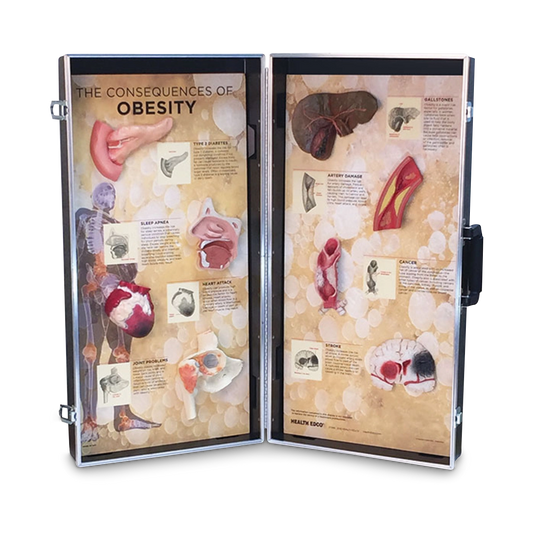 Consequences Of Obesity