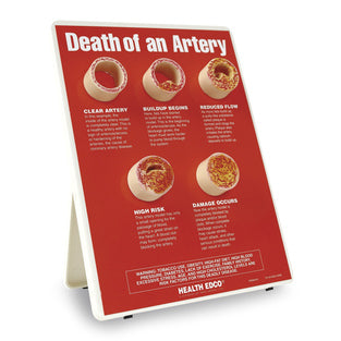 MODEL DEATH OF AN ARTERY
