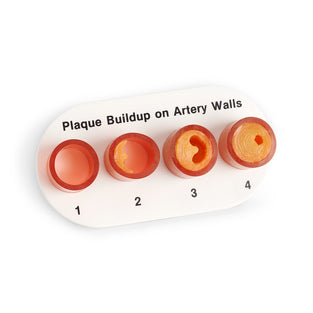 Artery Section with Blockage Model