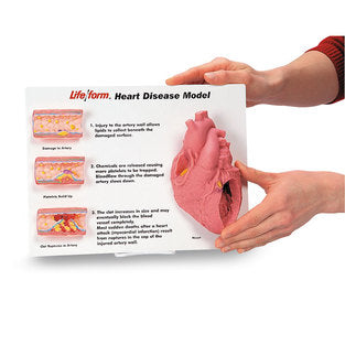 Nasco Artery/Heart Disease Display