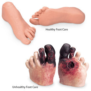 HEALTHY/UNHEALTHY FOOT SET