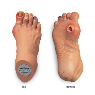 ADVANCED FOOT PROBLEMS